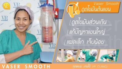 ดดไขมนตนแขน ทาใหดภาพกอนทำ หลงทำทนท จากแขนหอยๆ มไขมนสะสม ลดรอบแขนไปเยอะ วอารคลนก