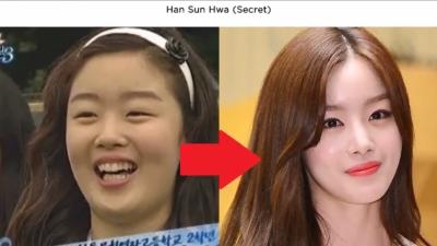 Korean Celebrity Plastic Surgery  Seoul Guide Medical